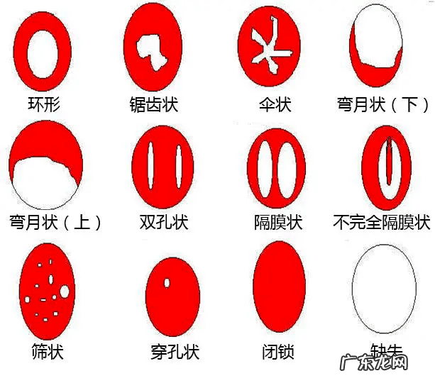 怎么看那层膜还在不在 修补处女膜