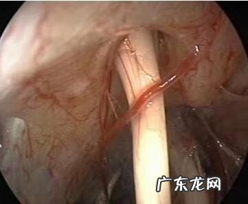 怎么样的风水使人耳鸣耳聋