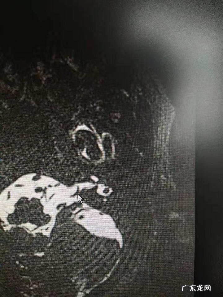 怎么样的风水使人耳鸣耳聋