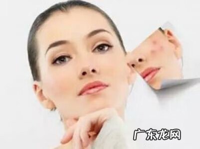黄褐斑和什么有关系 黄褐斑是怎么办