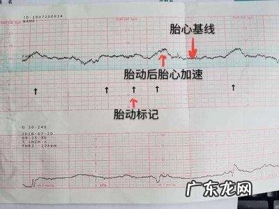 胎心监测怎么容易通过 胎心监测什么时候做最好