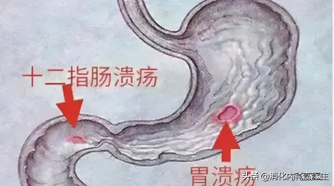 突然大便出鲜血 突然便鲜血是什么原因