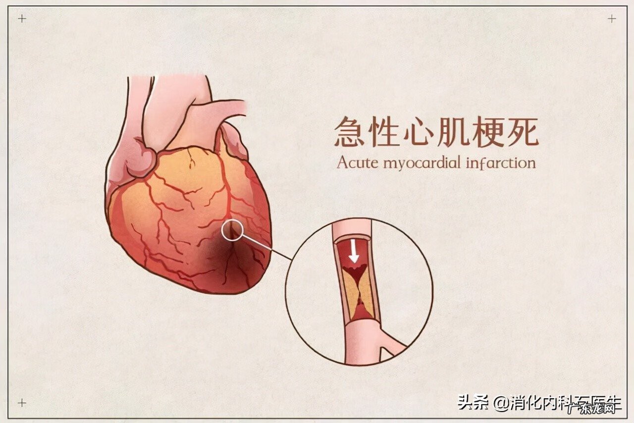 突然大便出鲜血 突然便鲜血是什么原因