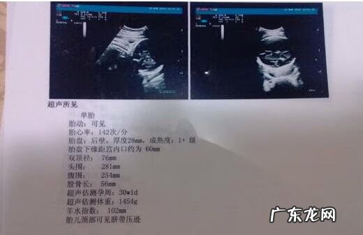 b超单看男女的方法 b超看男女多少钱