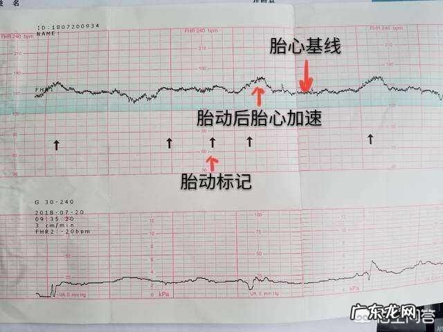 怀孕生男孩,胎心率是每分钟多少下?怀孕时应注意什么?