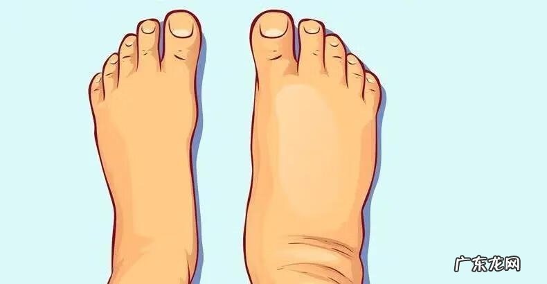 月经前水肿怎么办 月经前水肿正常吗