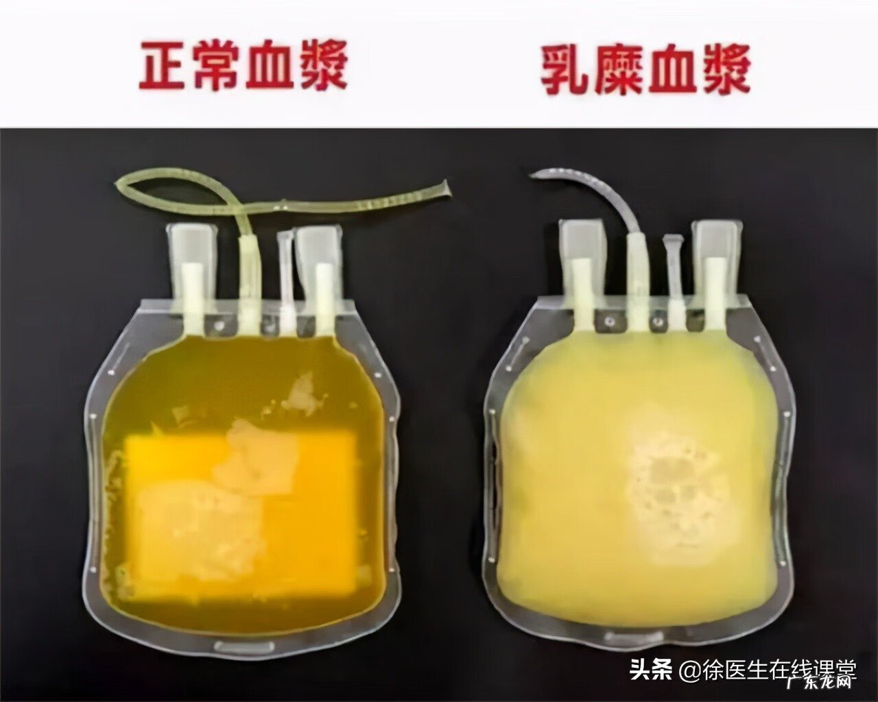 献血的十大好处和坏处 献血的好处和坏处都有哪些