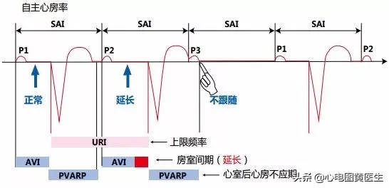 心电图详细图解 心电
