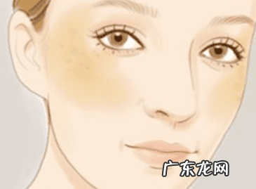 激光祛斑危害大吗 激光祛斑危害性