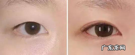 怎样可以把眼睛变大 眼睛怎样变大?