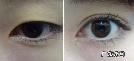怎样可以把眼睛变大 眼睛怎样变大?