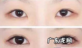 怎样可以把眼睛变大 眼睛怎样变大?