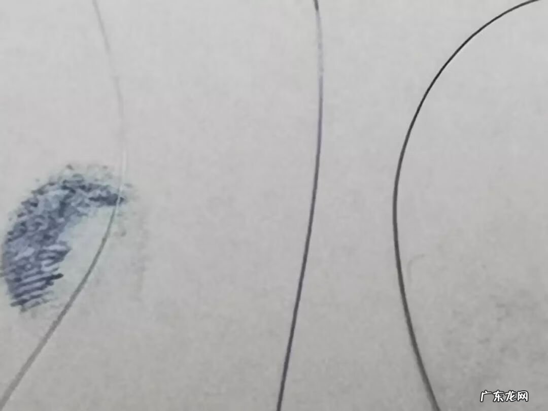 做了前后壁修复后悔 尿道修复手术