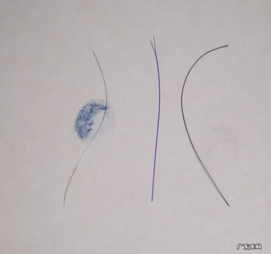 做了前后壁修复后悔 尿道修复手术