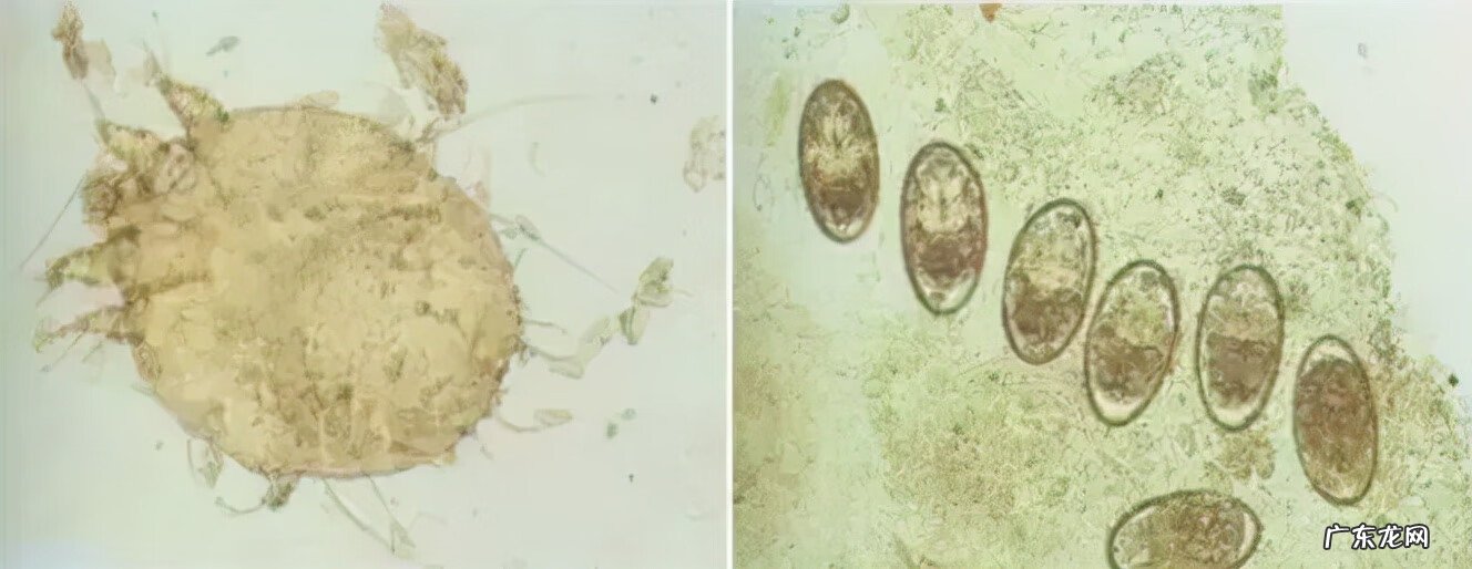 疳疮图片 疥疮图片