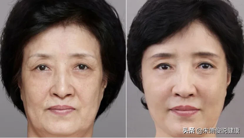 抗皱最好的方法是什么？