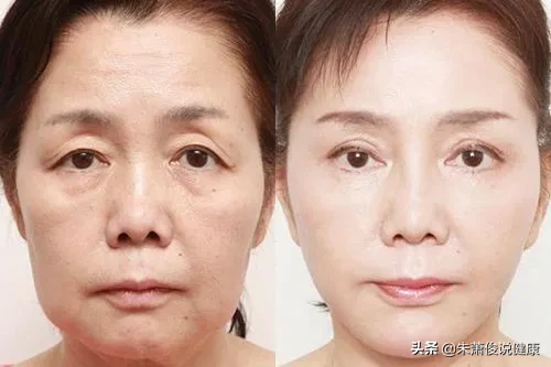 抗皱最好的方法是什么？