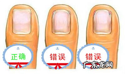 甲沟炎的家庭处理方法 甲沟炎怎么处理