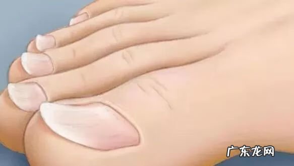 家里人脚受伤哪里风水不好 脚能看出什么病