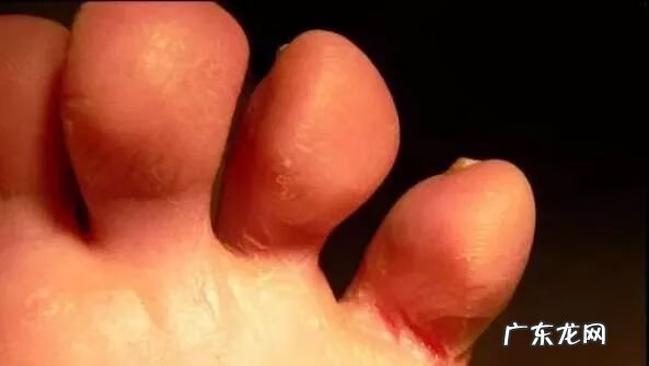 家里人脚受伤哪里风水不好 脚能看出什么病