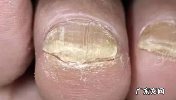 家里人脚受伤哪里风水不好 脚能看出什么病