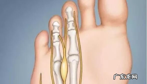 家里人脚受伤哪里风水不好 脚能看出什么病