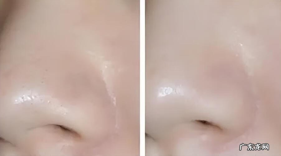 用什么可以收缩脸部毛孔呢 如何收缩面部毛孔