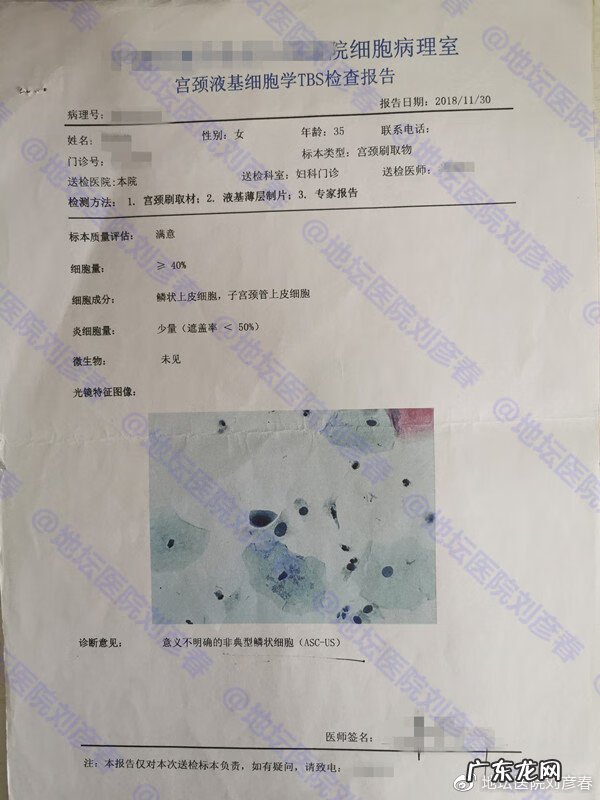 cin2级是什么意思 cin2