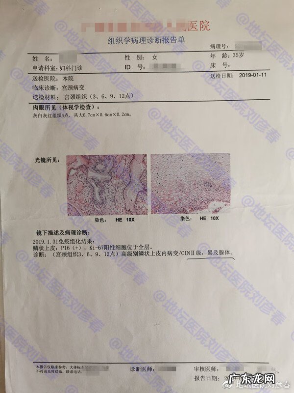 cin2级是什么意思 cin2