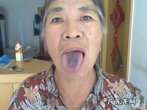 舌头有点发黑是怎么回事 舌头发黑是什么原因引起