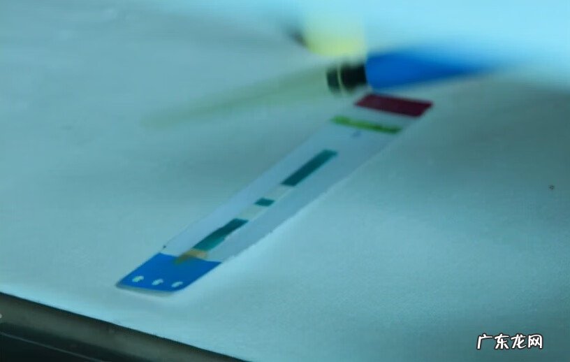 一般怎样才会得艾滋病 艾滋病怎么引起的主要