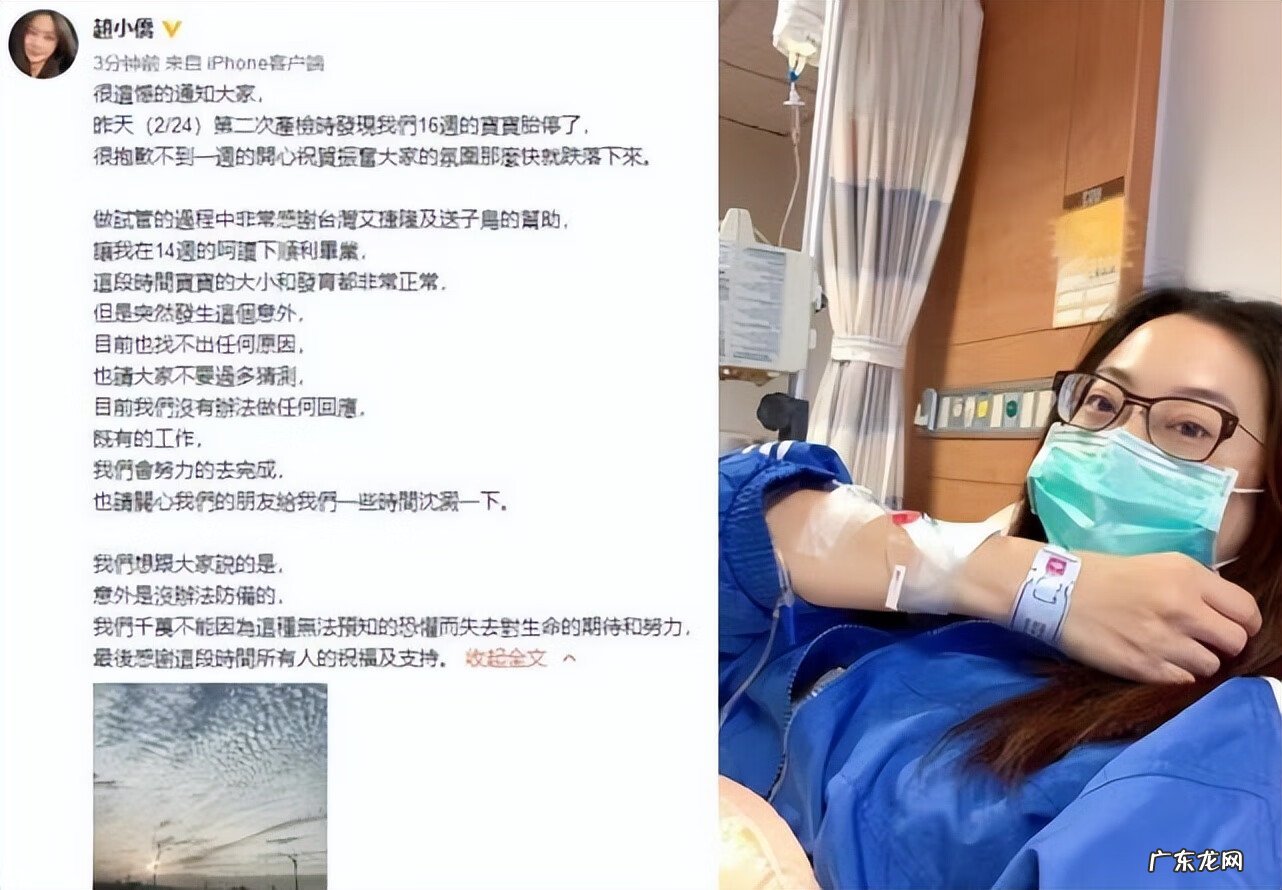 七个月的胎儿真实图片 怀孕七个月男胎儿图片