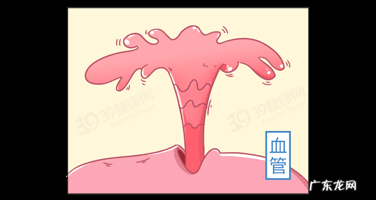 微创结扎手术费用 结扎费用一般多少钱