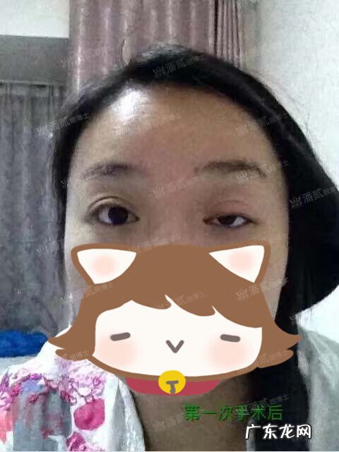 割双眼皮风水讲究 提拉眼皮会影响风水么