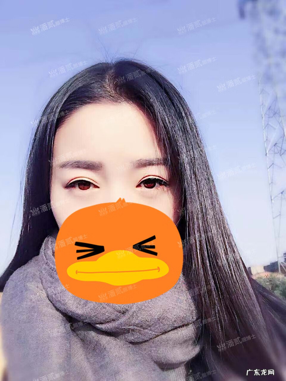 割双眼皮风水讲究 提拉眼皮会影响风水么