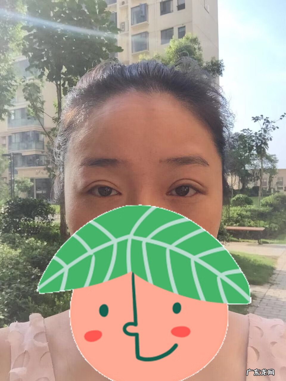 割双眼皮风水讲究 提拉眼皮会影响风水么