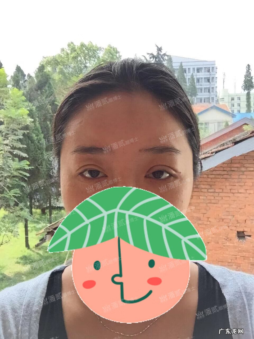 割双眼皮风水讲究 提拉眼皮会影响风水么