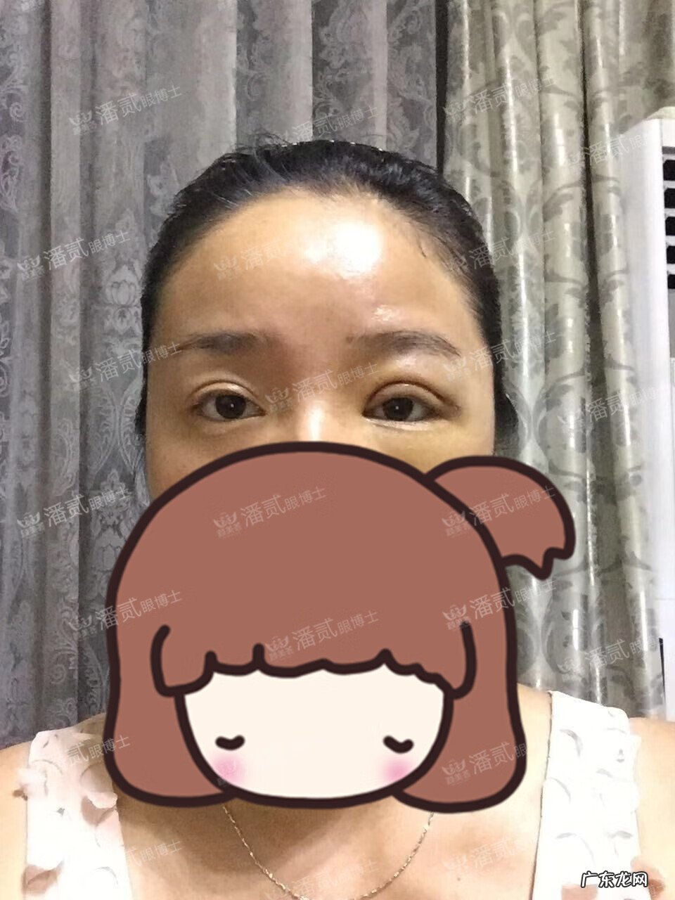 割双眼皮风水讲究 提拉眼皮会影响风水么