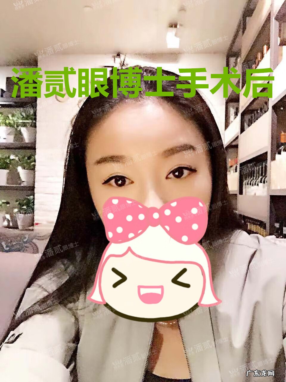 割双眼皮风水讲究 提拉眼皮会影响风水么