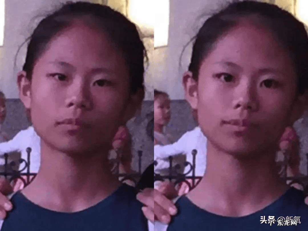 脸做美容手术要多少钱 做脸部整形手术费用