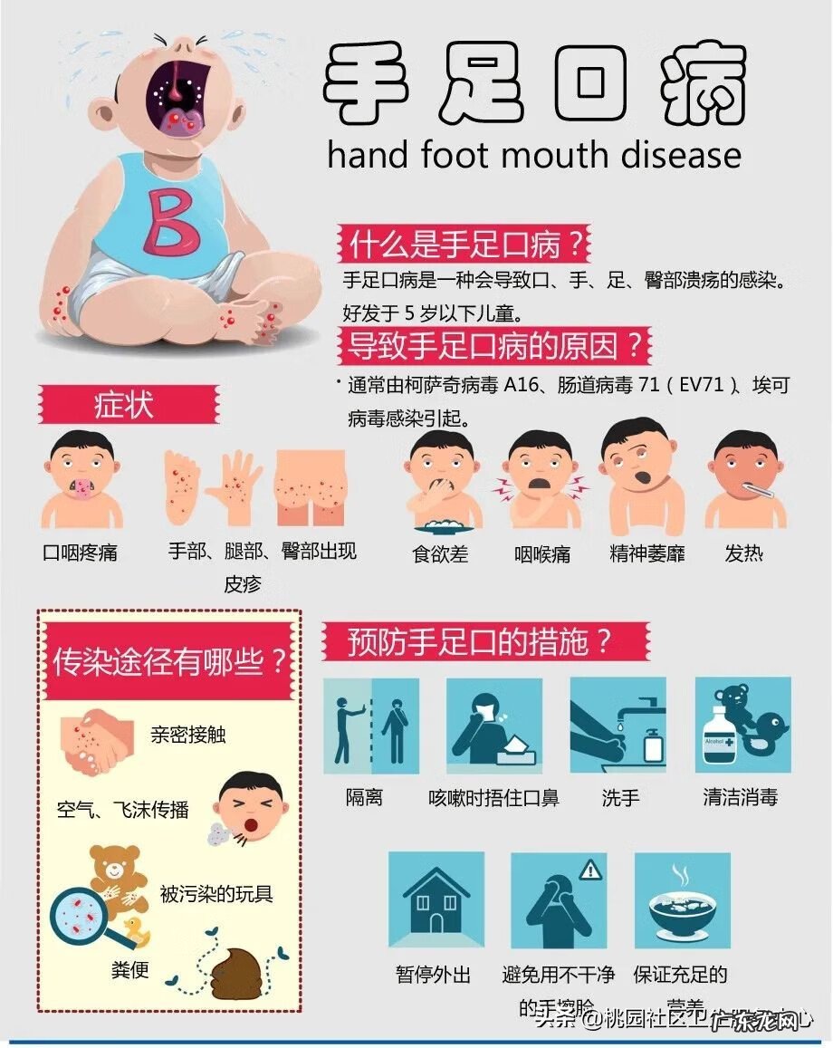 手足口开始好的征兆 手足口病