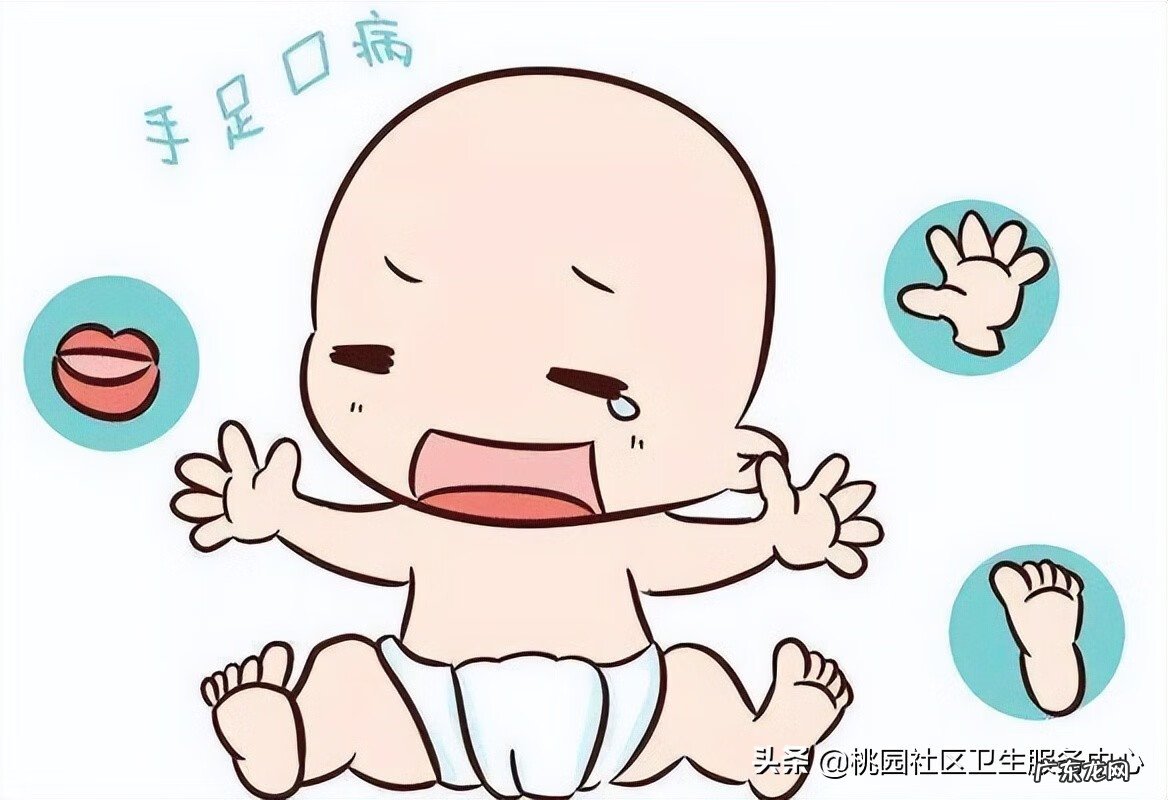 手足口开始好的征兆 手足口病