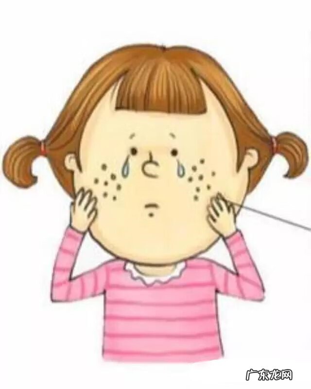 脸上一脸痘坑怎么办 脸上有痘坑怎么治疗