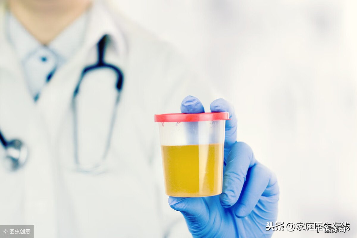 尿常规检查结果白细胞高 尿检白细胞高说明什么问题