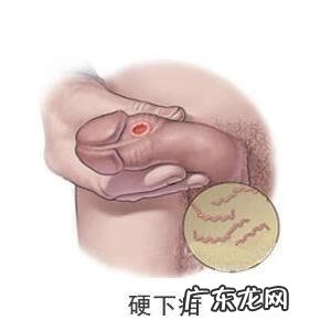 男性得了性疾病有什么症状图片 性疾病有哪几种都有哪些明显症状