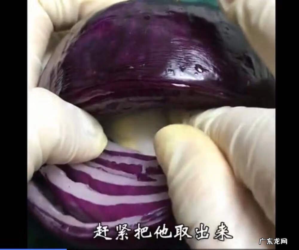 剖腹产多久可以过夫妻生活 抛腹产