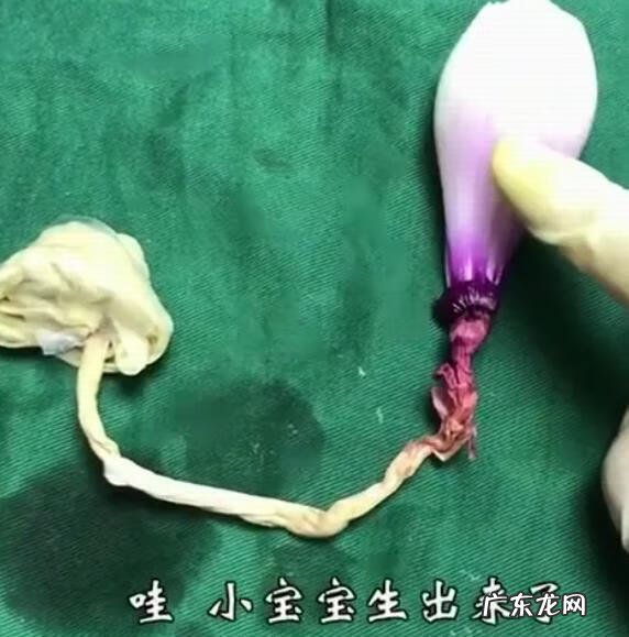 剖腹产多久可以过夫妻生活 抛腹产