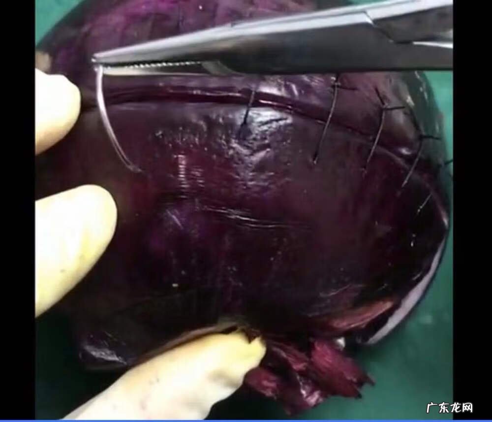 剖腹产多久可以过夫妻生活 抛腹产