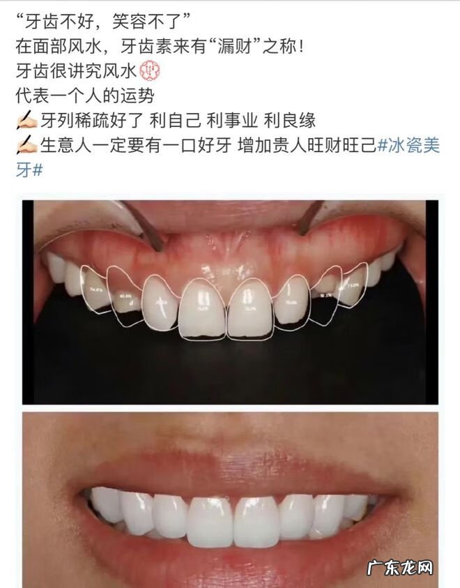 牙齿和风水有关系吗 蛀牙影响风水