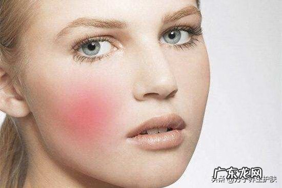 脸上出现红血丝该怎么解决 脸上有红血丝了怎么办